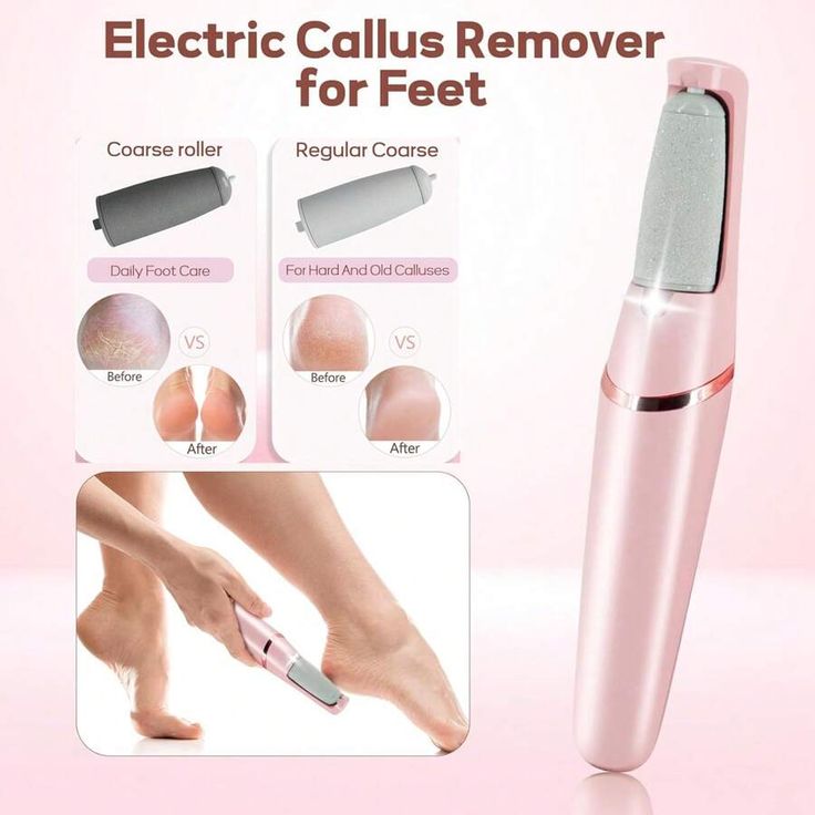 Electric Pedicure Foot File Callus Remove